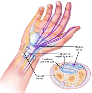 rankų pirštų tepalas į artritą