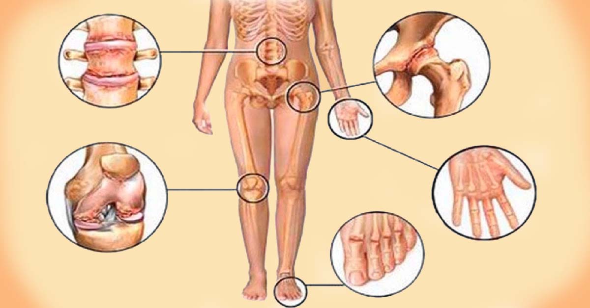 artrozė alkūnės gydymas liaudies gynimo priežastys rankų skausmo