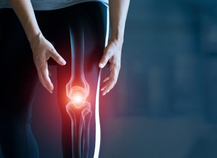 osteoartrito medikamentinis gydymas tepalas sąnarių ir ryšulius bėgikų