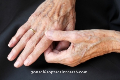 kaip padaryti rankos skauda artritas