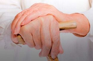 gydymas piršto sąnarių rankas artrozė 1 padikaulių
