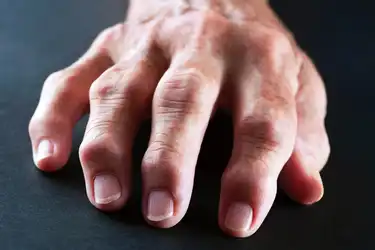 swelling between joints of fingers gydymas sąnarių rankos liaudies gynimo namuose