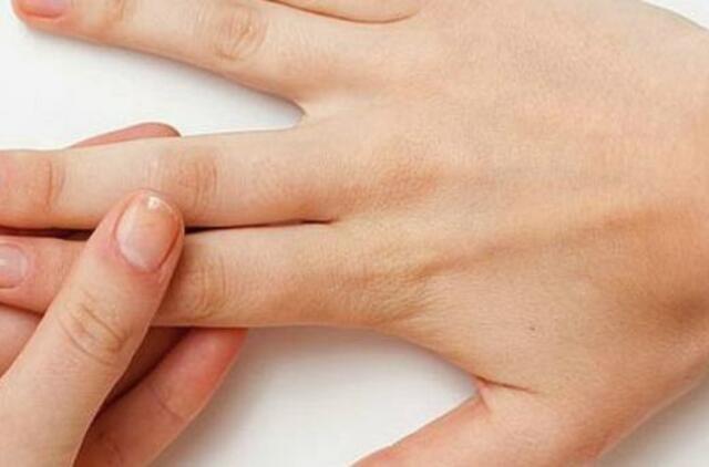 rankų gydyti gydymas kaip sustabdyti artroze