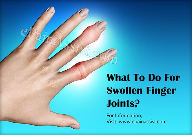 swollen painful joint in finger