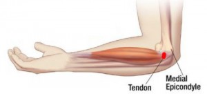 šykštuolis sąnarius skauda ranka gydymas alkūnės bendrą gydymo artrito