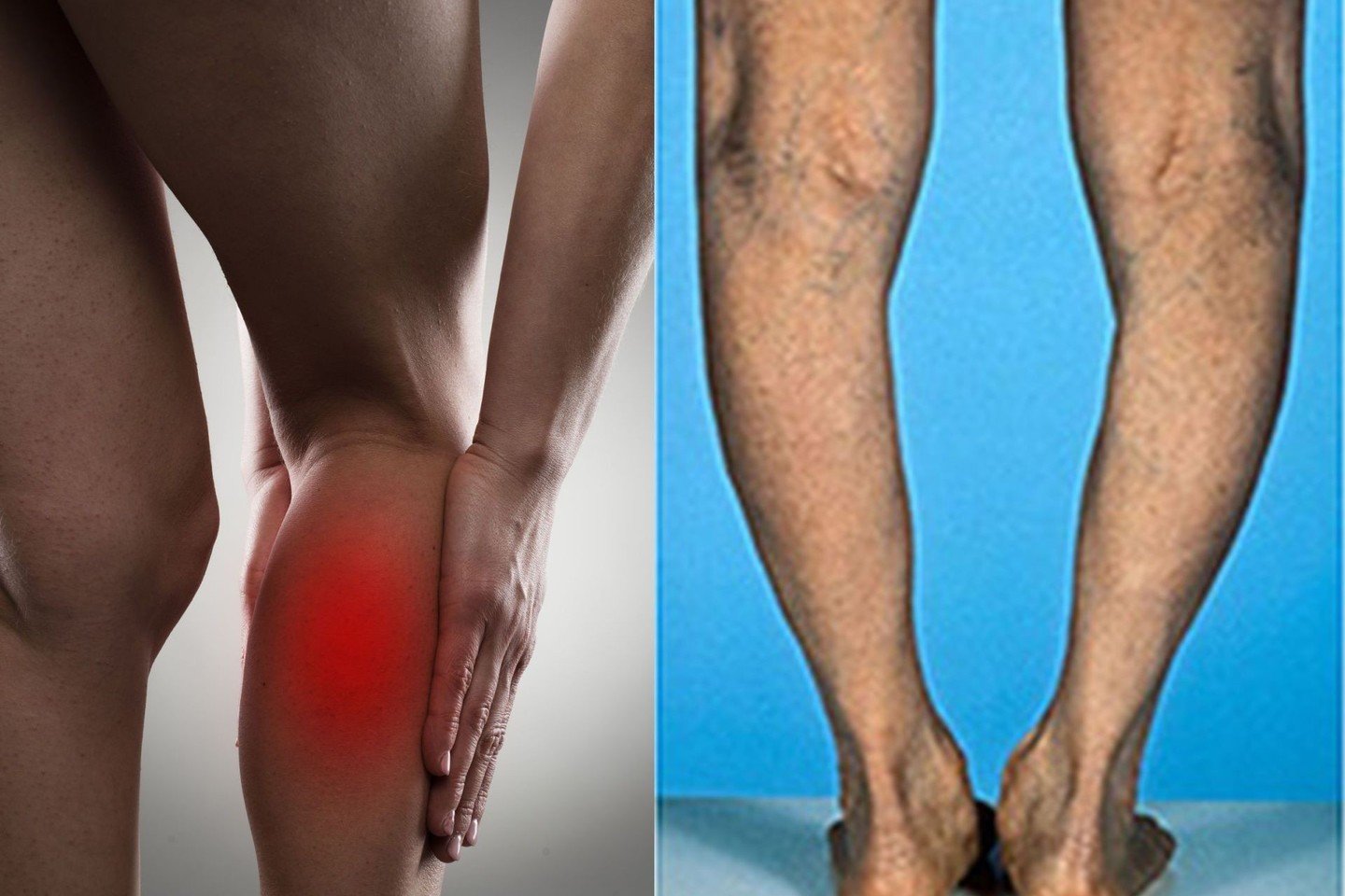 sąnarių skausmas visame kūne kuris yra artritas falanga nykščio