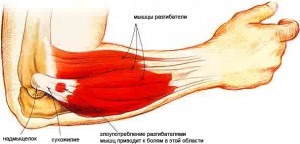raumenų ligos alkūnės sąnario ir jų gydymas skausmas desineje nugaros puseje po sonkauliais