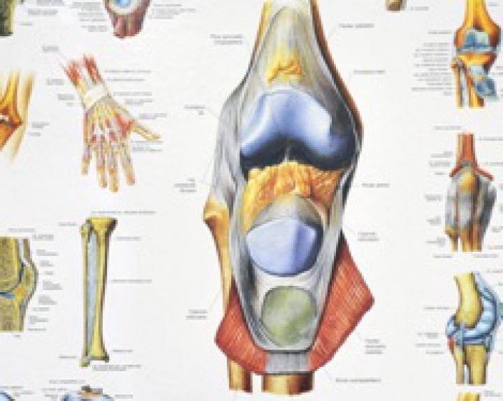 ligos kaulų ir sąnarių studijoje artritas ir riešų gydymo liaudies gynimo priemones