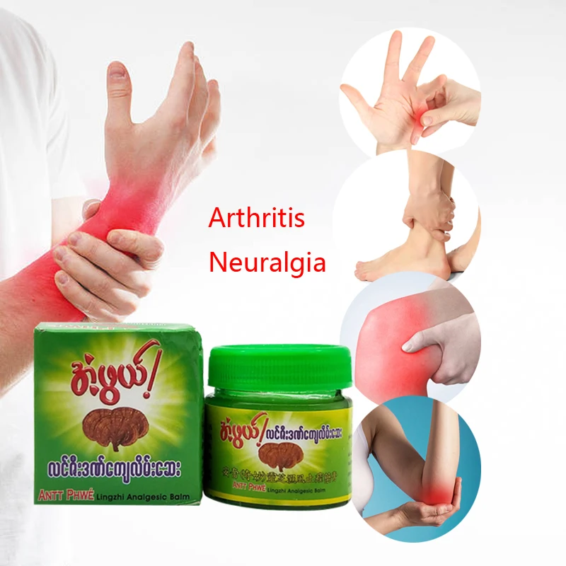 tepalas nuo arthrites sąnarių artrozė 4 laipsniai liaudies gynimo priemonių gydymas