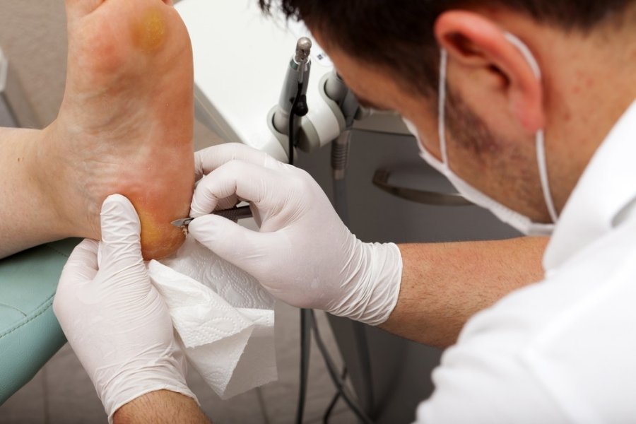 gydymas pėdos sąnario išminčiai sąnarių ligos