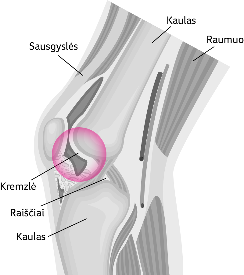 skausmas kojų priežastis ir gydymą sąnarių kaip sustabdyti artroze