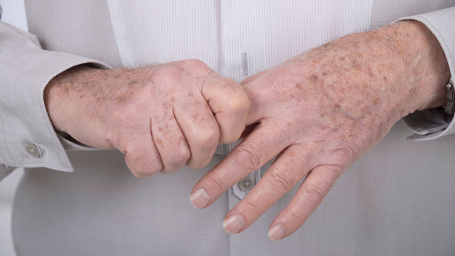 artrozė holding rankų valymo
