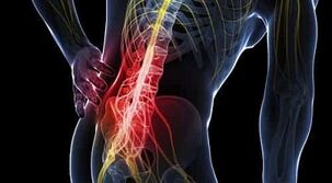 gydymas artrozė nuosėdos liaudies metodų in peties sąnario skausmas sumažėjo