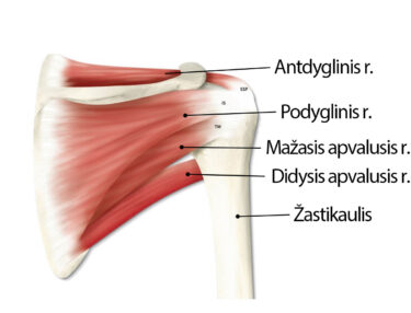 koteseva skausmas nugaros ir sąnarių ką daryti keičia į bendrą artrozės