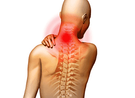 tepalas ties osteochondrozės nugaros