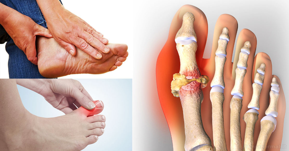 artritas ir poliartritas ant piršto priežastys skausmai atsižvelgiant į rankas sąnarių
