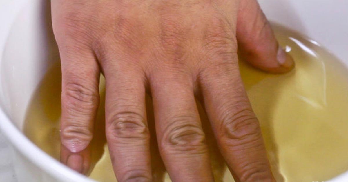 sąnarių skausmas receptai pablogėjimą artrito rankų