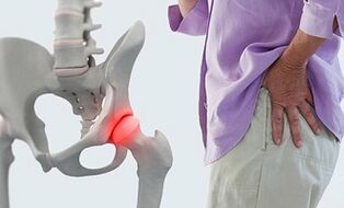 artrozė ir osteoartrito gydymui skausmui malšinti sąnarių