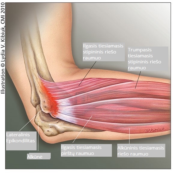 artrozė alkūnės sąnario gydymo atsiliepimai kojos sanario skausmas