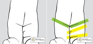 artritas poliartritas artrozė gydymas gydymas nuo mazi rankų sąnarių