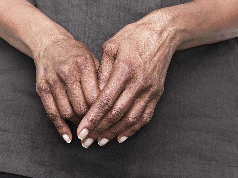 artritas simptomai iš žandikaulio sąnarių skausmai