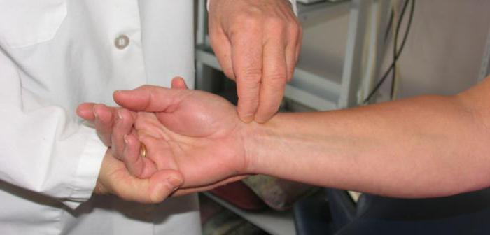uždegimas bendra šepečio rankų gydymo moterų skausmas skausmas gydymas
