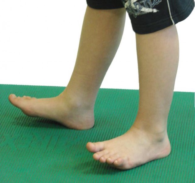 tempimo išlaikyti pėdų gydymas