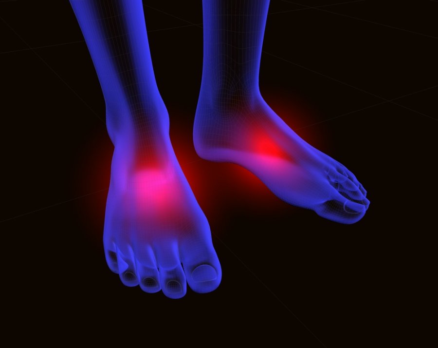 kas artrito gydymui ant kojų
