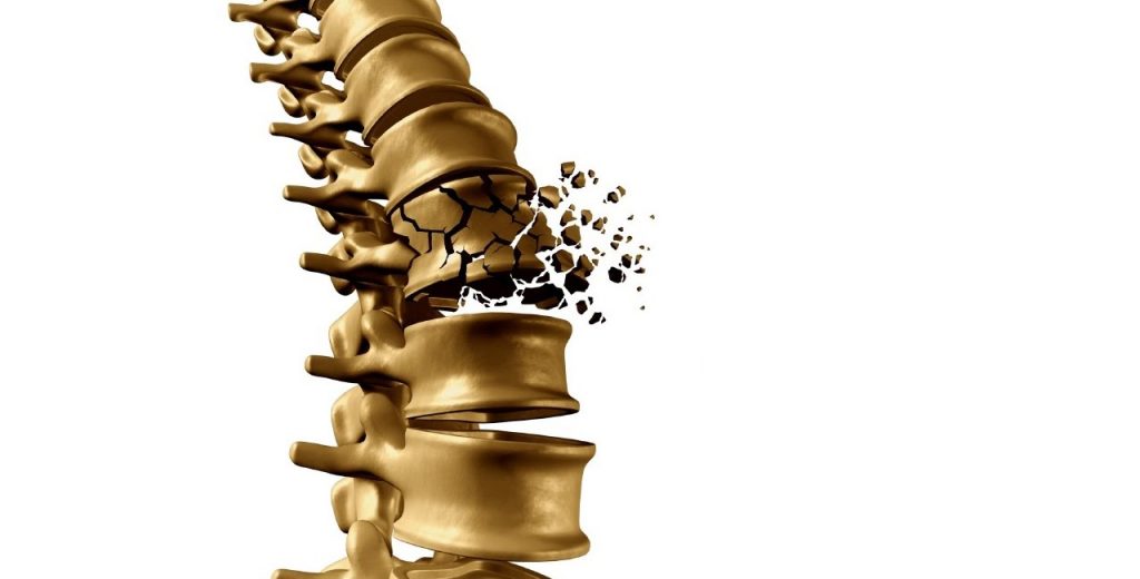 homeopatinis vaistas osteochondrozės visos nugaros reumatoidinis artritas neigalumas