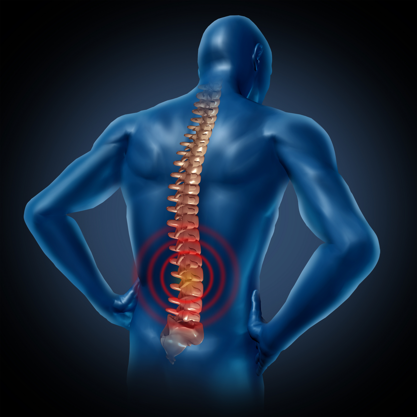 nugaros skausmas vaistai ar komisiniai su artrozės sąnarių