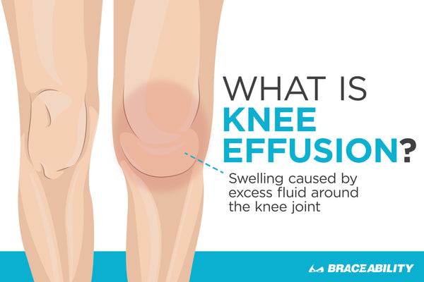 swollen painful knee joint