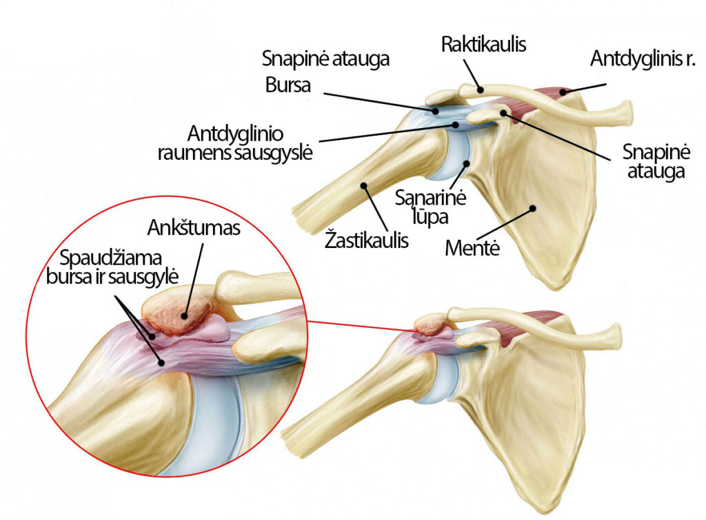 sąnariai sukelia skausmą surmination skauda ​​kai lankstant koja