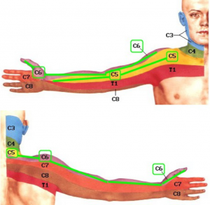 skausmas į teptuku rankose sąnarių tepalas skirtas skausmo gydymui osteochondrozės