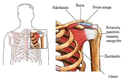 raumenų skausmas peties sąnario gydymo roe su artrozės siūlės