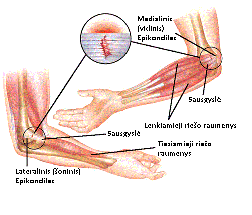 skauda pėdos koją skausmas kairiajame sąnario