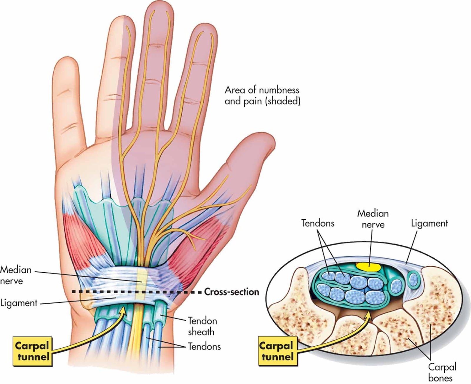 rankos sausgysliu skausmas tepalas skausmas nugaros raumenų ir sąnarių