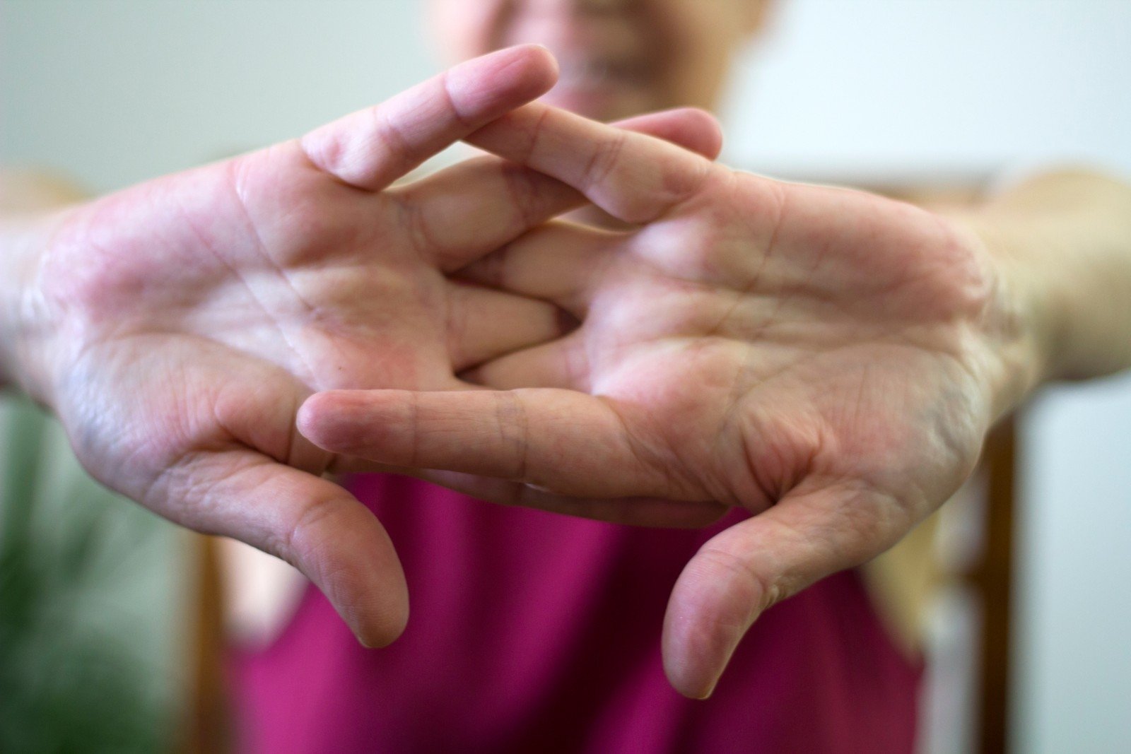 ką daryti su į rankas sąnarių skausmo gydymas artrozės į paūmėjimo