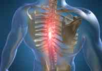 kaip padaryti oasy osteochondrozė tepalas gydomųjų raumenų ir sąnarių