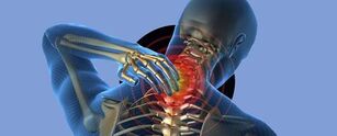 liaudies gynimo priemonės nuo kaklo slankstelių osteochondrozės gydymas arthrisa tb sąnariai