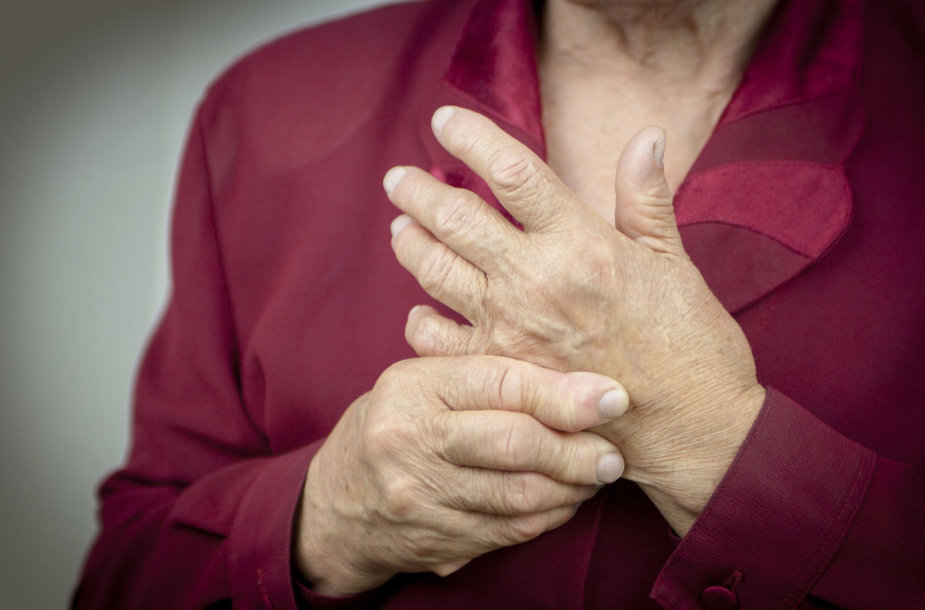 uždegimas sąnario ant rankų pirštu gydymas arthrisa vertus