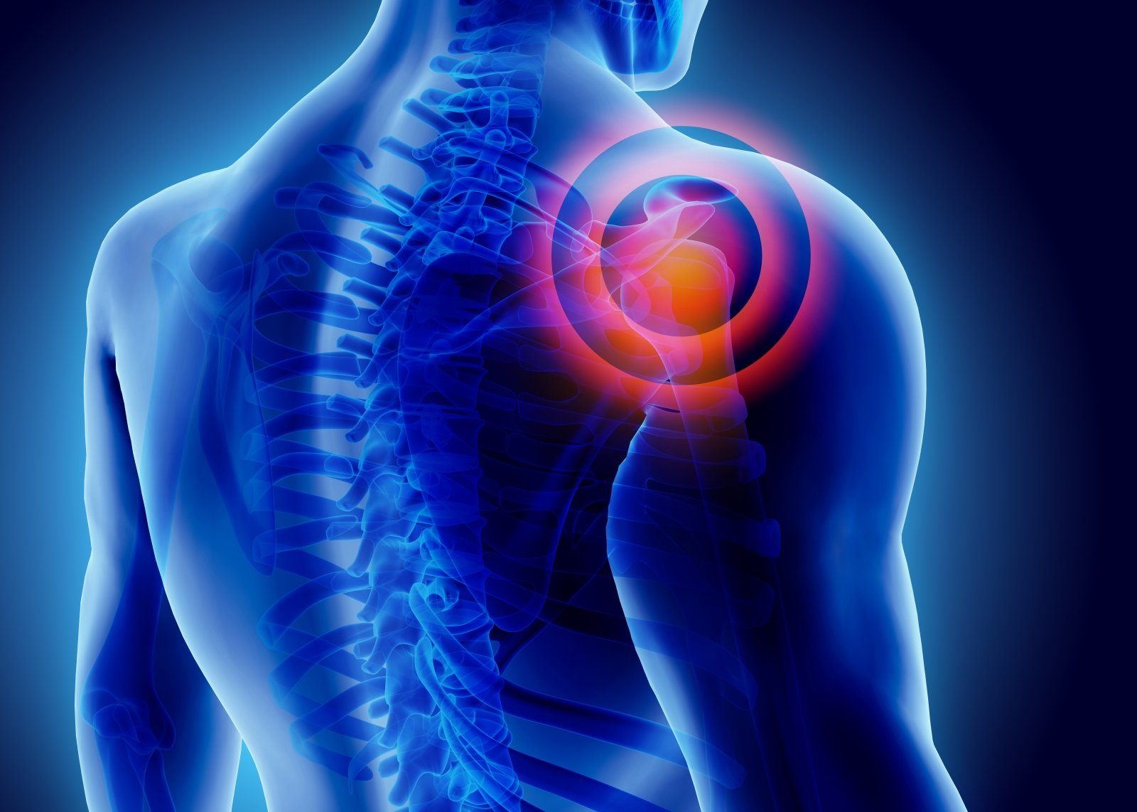 milgamma su osteoartritu peties sąnario raumenų skausmas sąnarių ir nugaros apačioje
