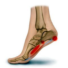 sharp skausmas pėdos pėdos