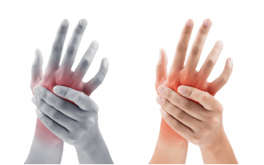 skauda rankas ir nustoti šepečiai sąnarius swelling in joints on one side of body