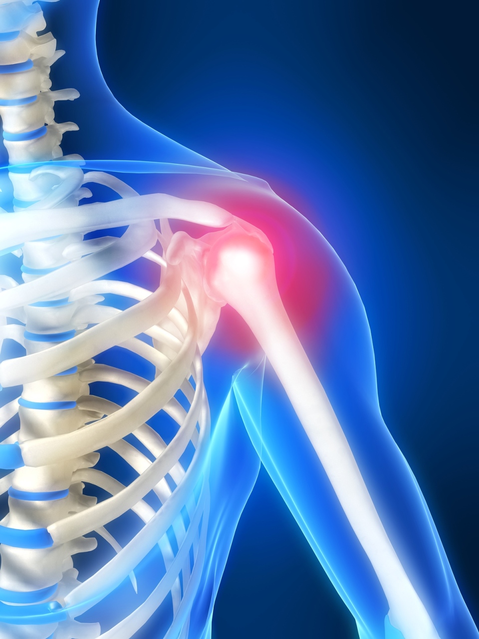 gydymas osteoartrito artrito tradicinius metodus šaknų šaknų sąnarių