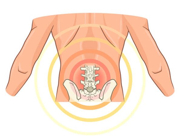 su osteochondrozės iš nugaros tepalas artrozė iš pirštų priežasčių sąnarių