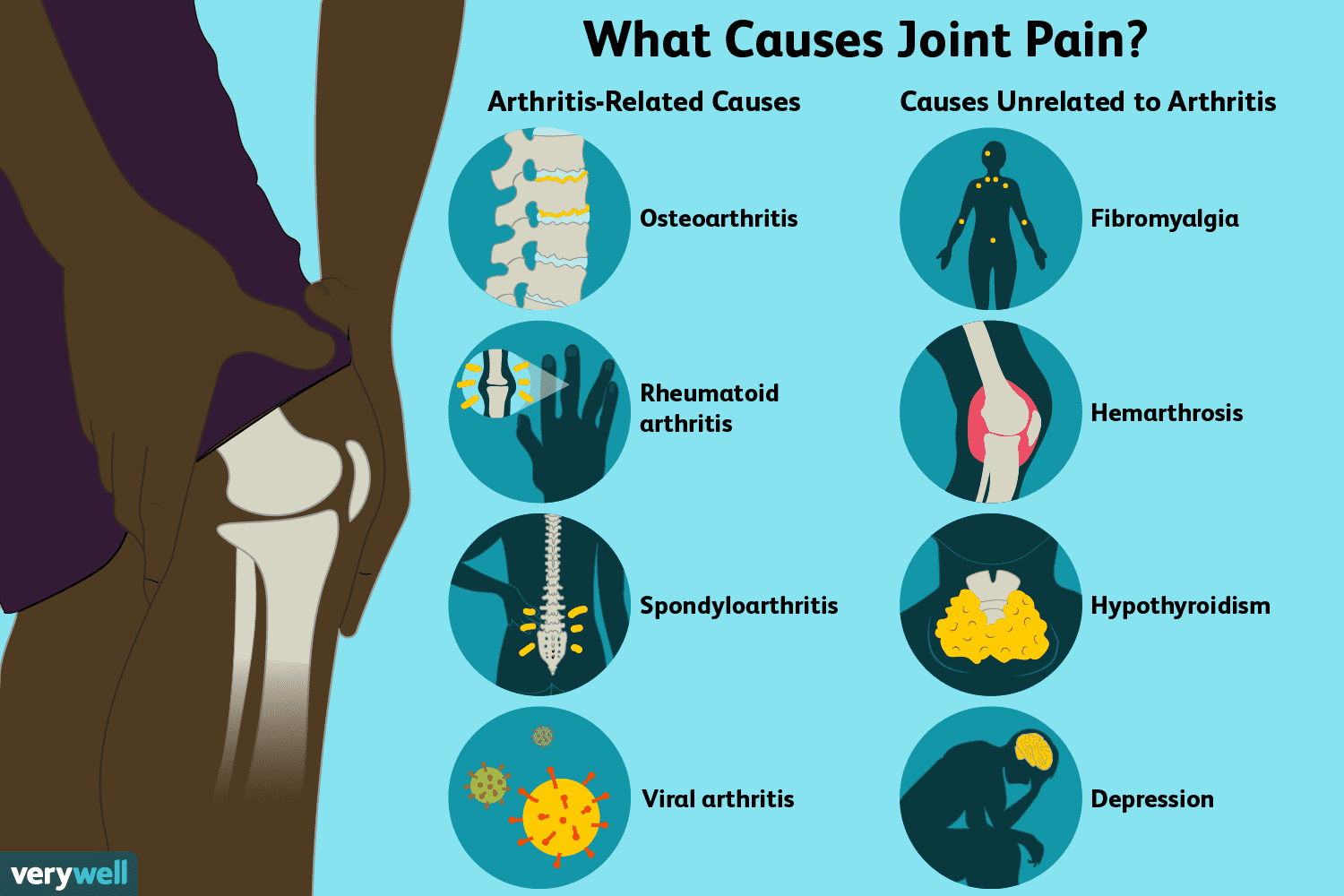 swelling in joints causes žandikaulio skausmas žandikaulio gydymas
