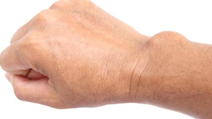swollen painful wrist joint