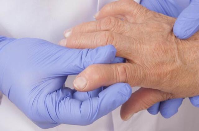 staiga liga rankų sąnarius artritas iš piršto sąnario paauglys