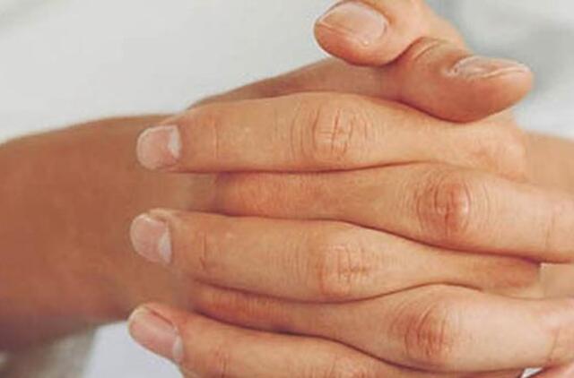 reumatoidinis artritas sąnarių žandikaulių maži skausmo skausmai šepečiai