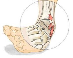 patinimas pėdos sąnario vitaminas kompleksas sąnarių gydymas